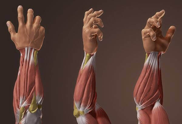 πόνος στον πήχη - τενοντίτιδα μυών του πήχη